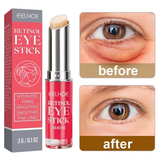 Anti-wrinkle Eye Cream Retinol Remove Eye Bags Dark Circles Anti Aging Lifting Firming Whitening Moisturizing Brighten Skin Care