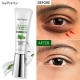 Joypretty Anti Dark Circle Eye Cream Anti Wrinkle Fade Fine Lines Remove Eye Bags Puffiness Lifting Skin Care Beauty Health