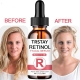 Retinol Face Serum 2-5% With Hyaluronic Acid Anti Wrinkle Whitening Moisturizing Brightening Retinol Essence Skin Care